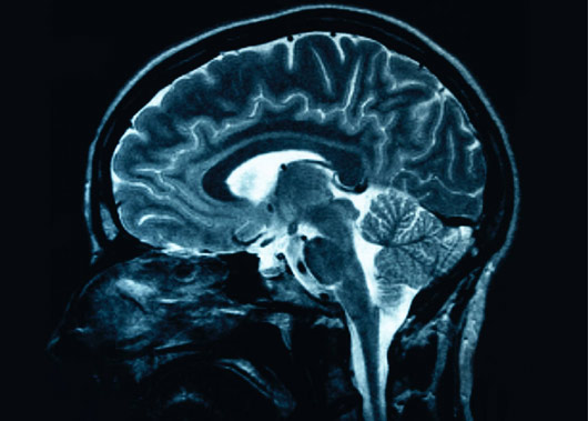 brain-scan_global-intelligence.jpg